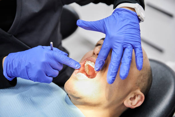 Best Broken or Cracked Tooth Emergency Dentist in Port St Lucie, FL